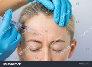 Anti-wrinkle Injections prevent the skin from creasing or causing wrinkles