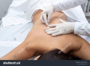 Dermaplanning