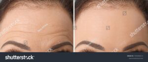 aesthetics clinic in central London